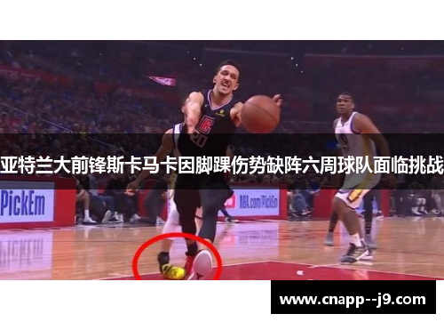 亚特兰大前锋斯卡马卡因脚踝伤势缺阵六周球队面临挑战 亚特兰大前锋斯卡马卡因脚踝伤势缺阵六周球队面临挑战
